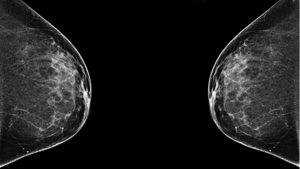 The Art of Stillness