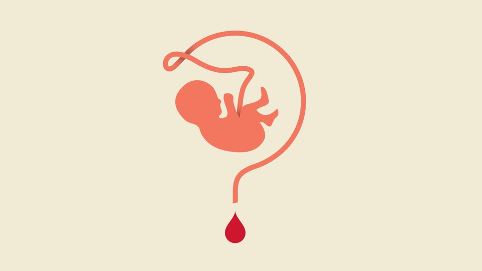 Is Cord-Blood Banking Worth It?